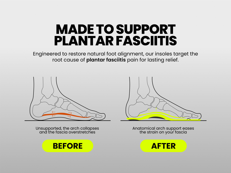 Is Your Plantar Fasciitis Actually Getting Better? 6 Signs of Real Progress
